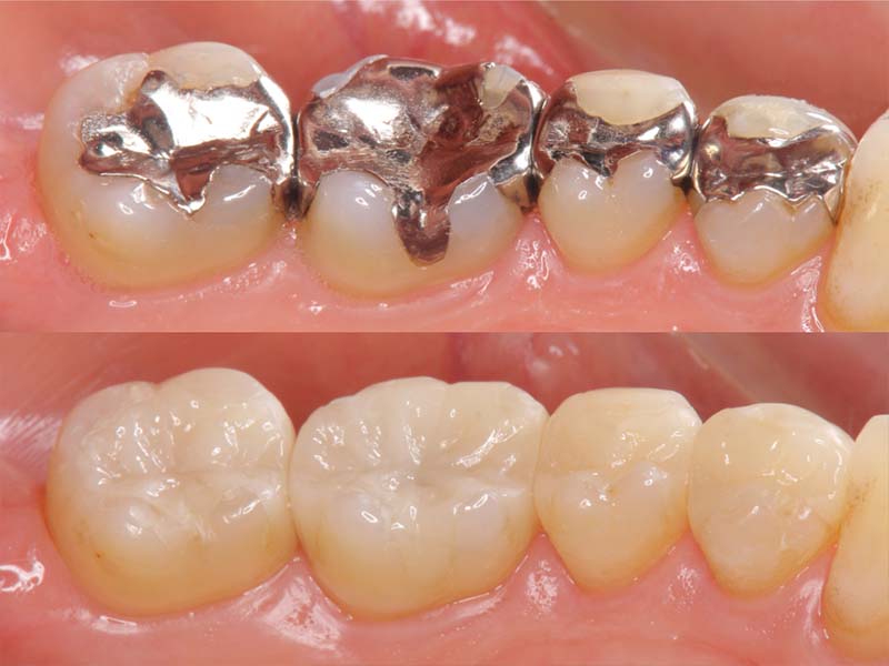 Zahnheilkunde Leistungen | Dr. Wegner - Zahnarzt Kiel